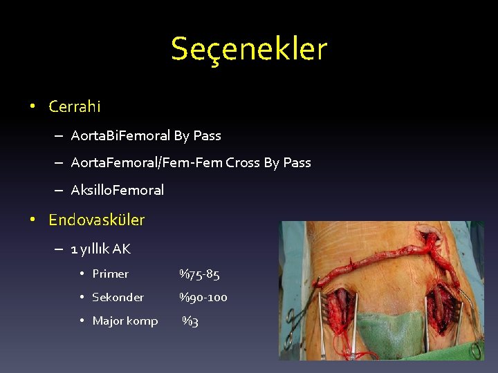 Seçenekler • Cerrahi – Aorta. Bi. Femoral By Pass – Aorta. Femoral/Fem-Fem Cross By