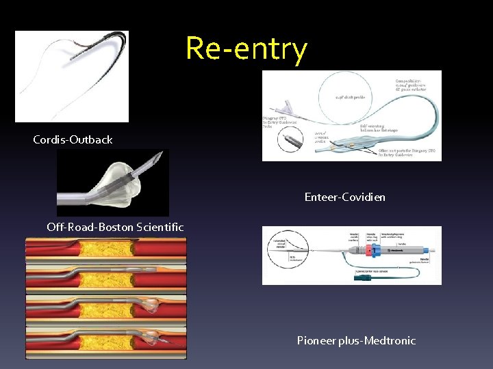 Re-entry Outback-Cordis-Outback Enteer-Covidien Off-Road-Boston Scientific Pioneer plus-Medtronic 