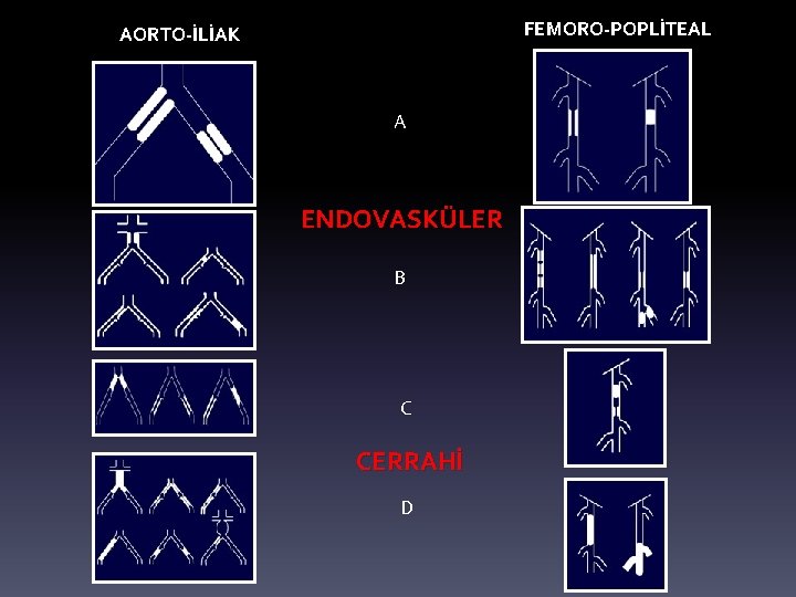 FEMORO-POPLİTEAL AORTO-İLİAK A ENDOVASKÜLER B C CERRAHİ D 