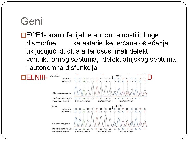 Geni �ECE 1 - kraniofacijalne abnormalnosti i druge dismorfne karakteristike, srčana oštećenja, uključujući ductus