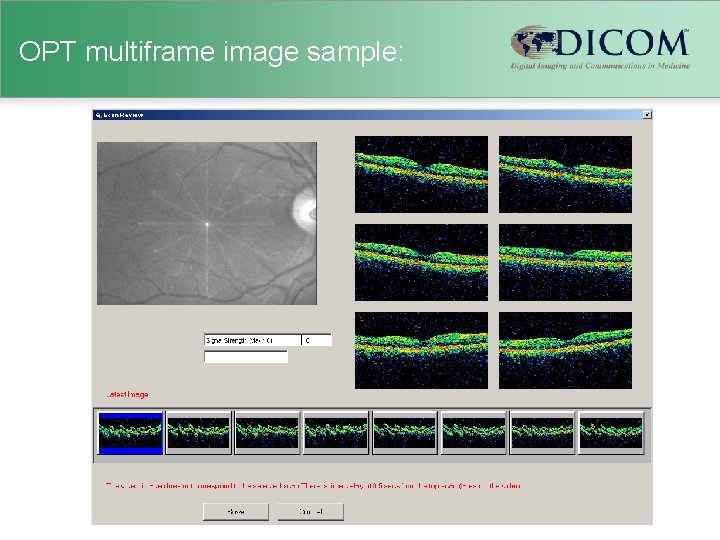 OPT multiframe image sample: 