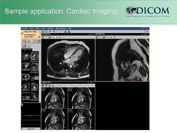 Sample application: Cardiac Imaging 