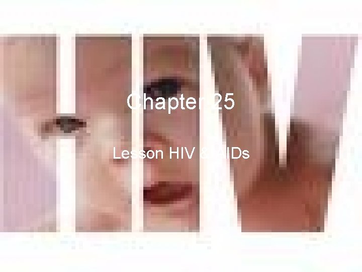 Chapter 25 Lesson HIV & AIDs 