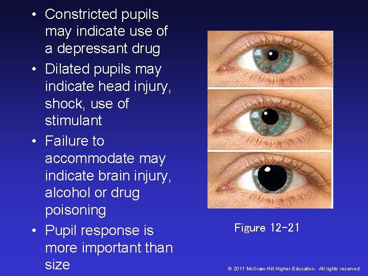 • Constricted pupils may indicate use of a depressant drug • Dilated pupils • Constricted pupils may indicate use of a depressant drug • Dilated pupils