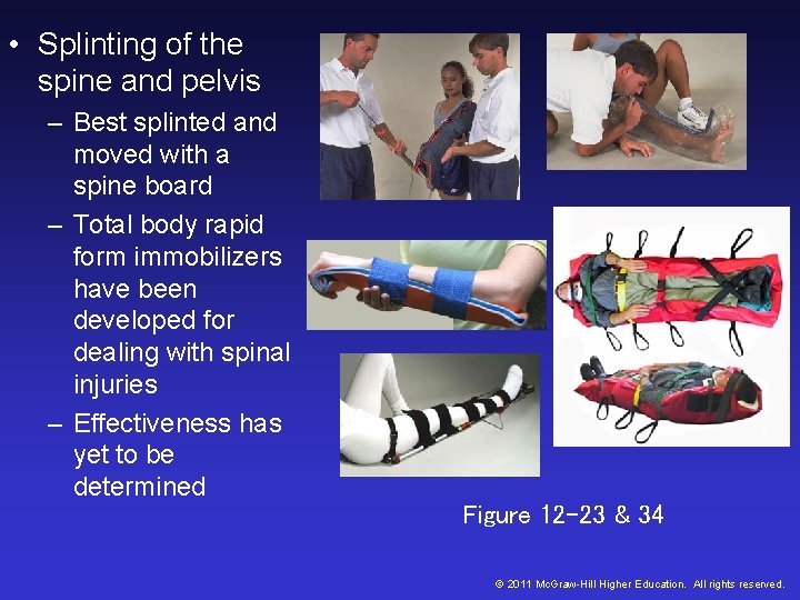 • Splinting of the spine and pelvis – Best splinted and moved with • Splinting of the spine and pelvis – Best splinted and moved with