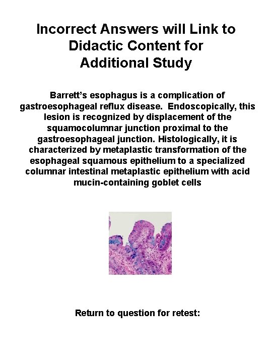 Incorrect Answers will Link to Didactic Content for Additional Study Barrett’s esophagus is a