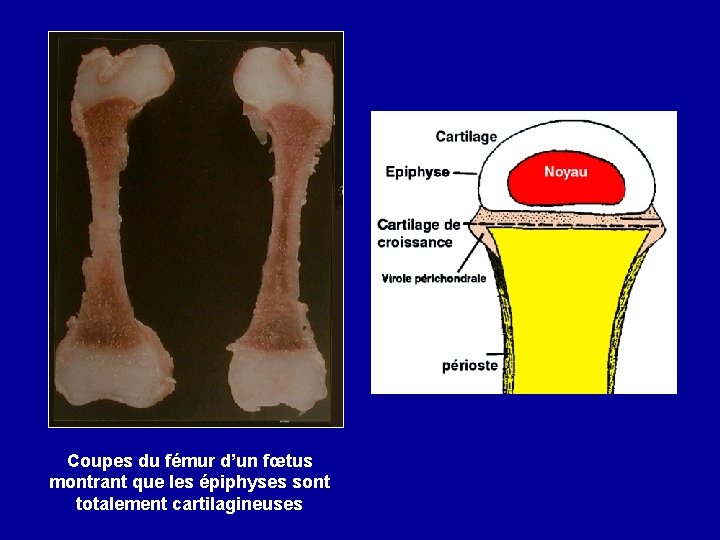 Coupes du fémur d’un fœtus montrant que les épiphyses sont totalement cartilagineuses 