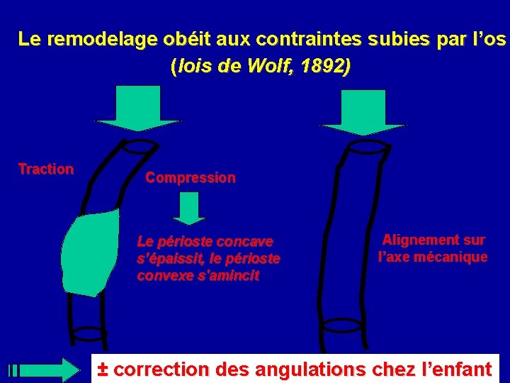 Le remodelage obéit aux contraintes subies par l’os (lois de Wolf, 1892) Traction Compression