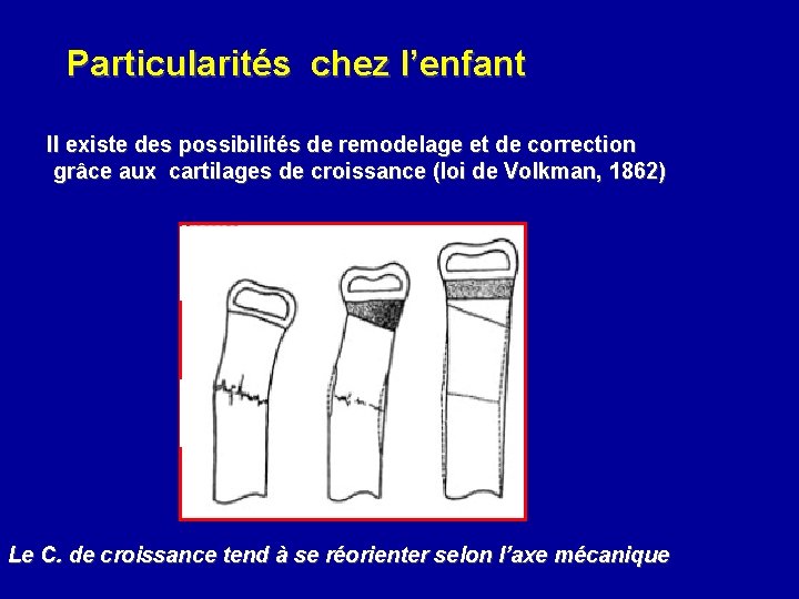 Particularités chez l’enfant Il existe des possibilités de remodelage et de correction grâce aux