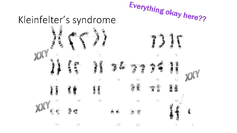 Everyth Kleinfelter’s syndrome ing ok ay her e? ? 