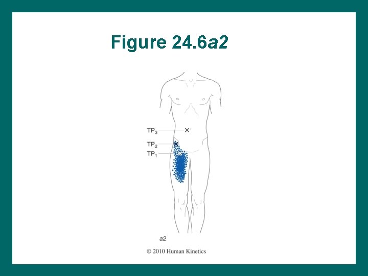 Figure 24. 6 a 2 