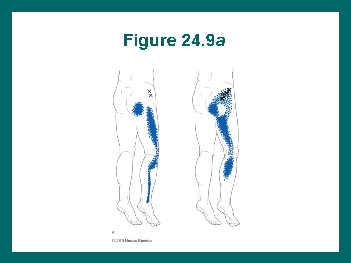 Figure 24. 9 a 