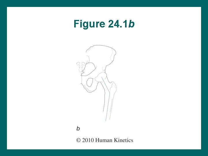 Figure 24. 1 b 