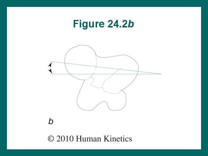Figure 24. 2 b 