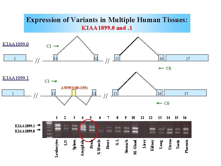 Expression of Variants in Multiple Human Tissues: KIAA 1099. 0 and. 1 KIAA 1099.