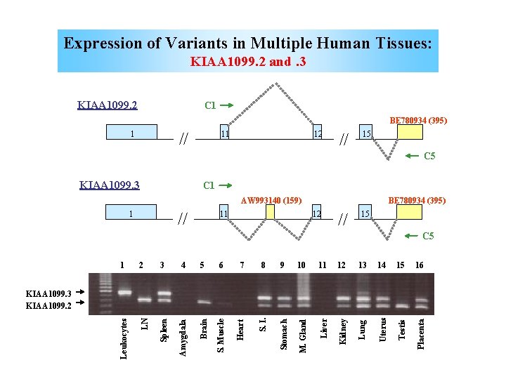 Expression of Variants in Multiple Human Tissues: KIAA 1099. 2 and. 3 KIAA 1099.