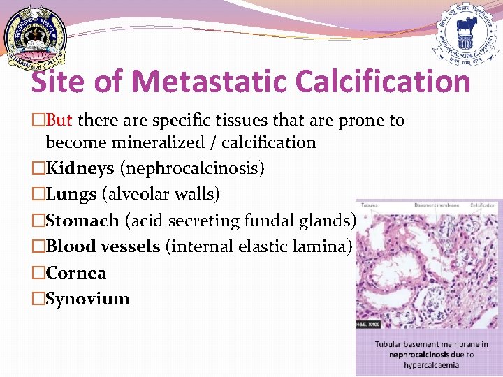 Site of Metastatic Calcification �But there are specific tissues that are prone to become