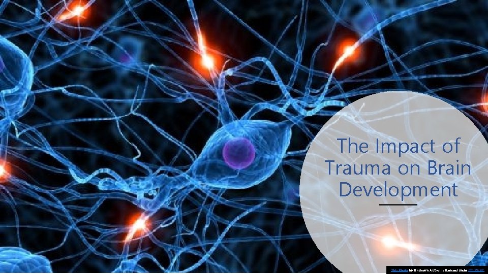 The Impact of Trauma on Brain Development This Photo by Unknown Author is licensed