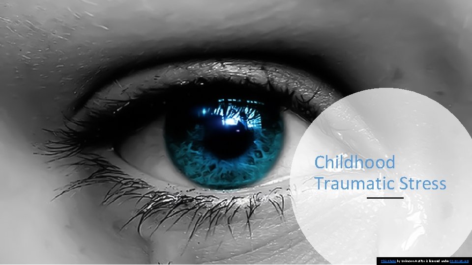 Childhood Traumatic Stress This Photo by Unknown Author is licensed under CC BY-NC-ND 