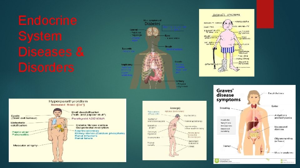 Endocrine System Diseases & Disorders 