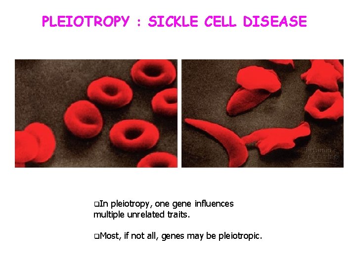 PLEIOTROPY : SICKLE CELL DISEASE q. In pleiotropy, one gene influences multiple unrelated traits.