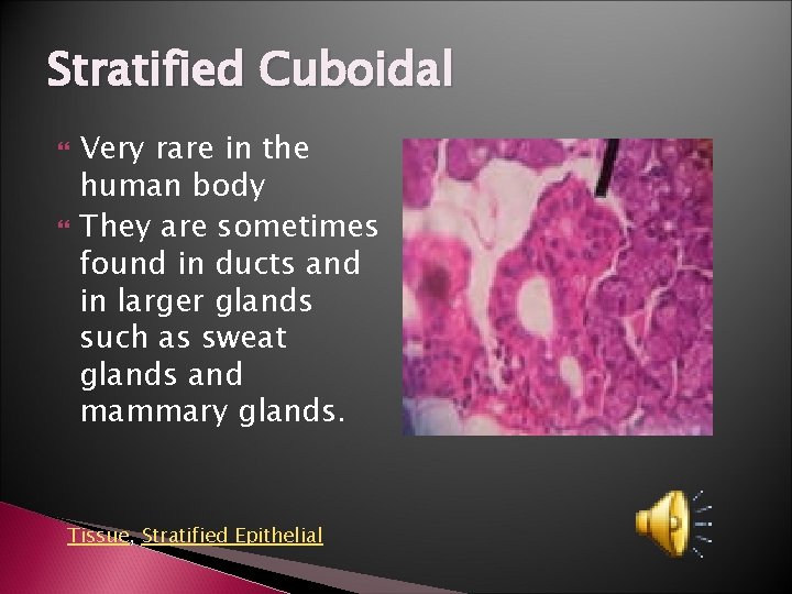 Stratified Cuboidal Very rare in the human body They are sometimes found in ducts