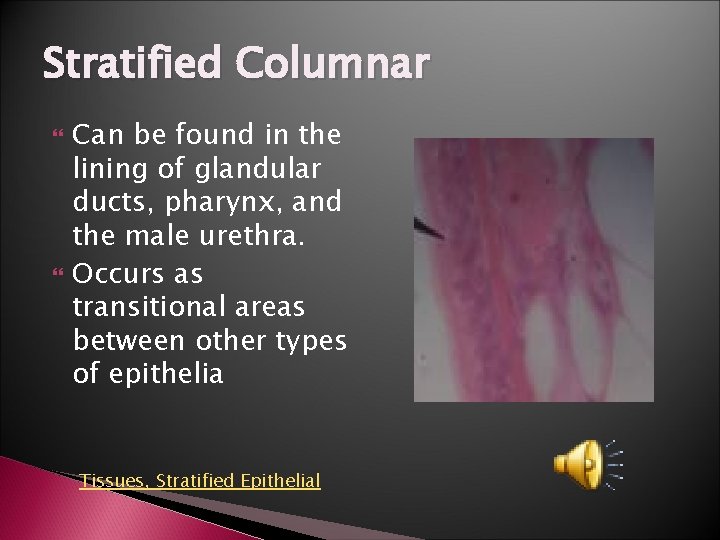 Stratified Columnar Can be found in the lining of glandular ducts, pharynx, and the