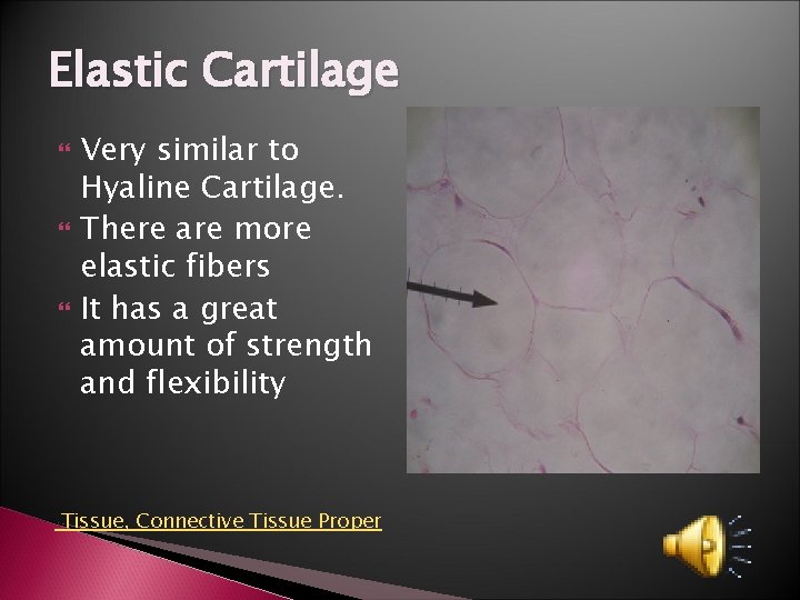 Elastic Cartilage Very similar to Hyaline Cartilage. There are more elastic fibers It has