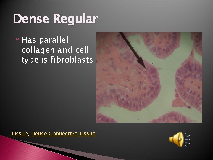 Dense Regular Has parallel collagen and cell type is fibroblasts Tissue, Dense Connective Tissue