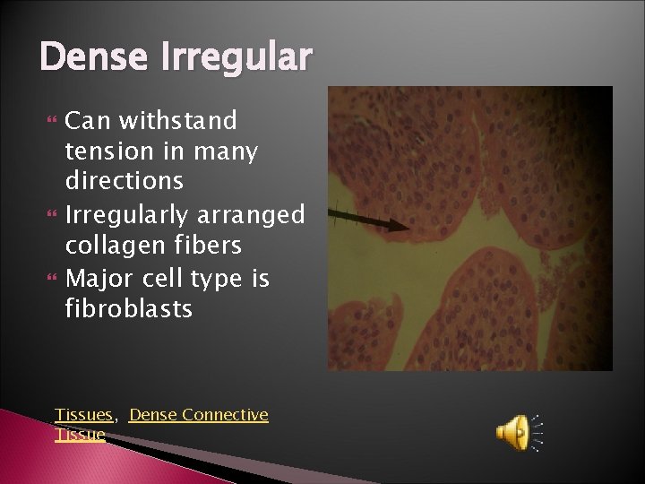 Dense Irregular Can withstand tension in many directions Irregularly arranged collagen fibers Major cell