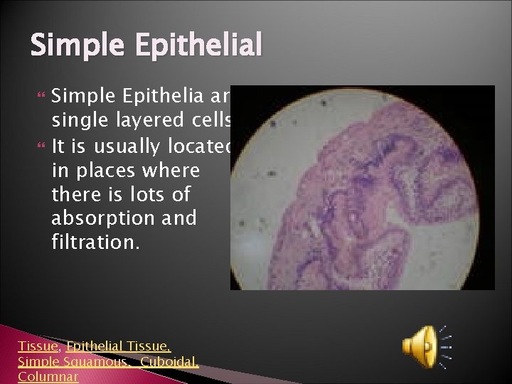 Simple Epithelial Simple Epithelia are single layered cells It is usually located in places