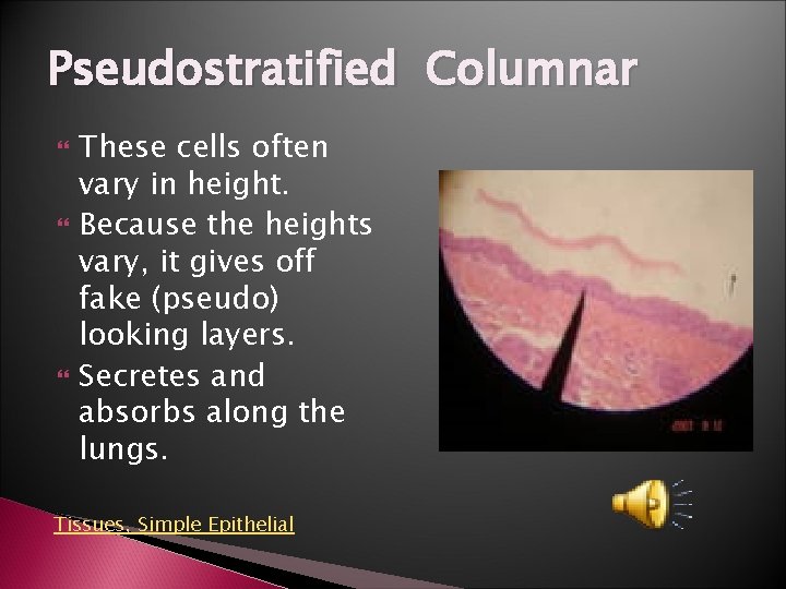 Pseudostratified Columnar These cells often vary in height. Because the heights vary, it gives