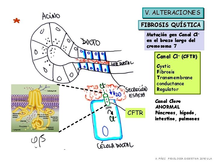 * V. ALTERACIONES FIBROSIS QUÍSTICA Mutación gen Canal Clen el brazo largo del cromosoma