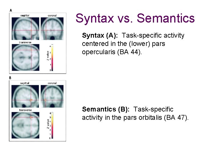 Syntax vs. Semantics Syntax (A): Task-specific activity centered in the (lower) pars opercularis (BA Syntax vs. Semantics Syntax (A): Task-specific activity centered in the (lower) pars opercularis (BA