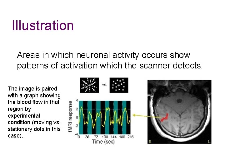 Illustration Areas in which neuronal activity occurs show patterns of activation which the scanner Illustration Areas in which neuronal activity occurs show patterns of activation which the scanner