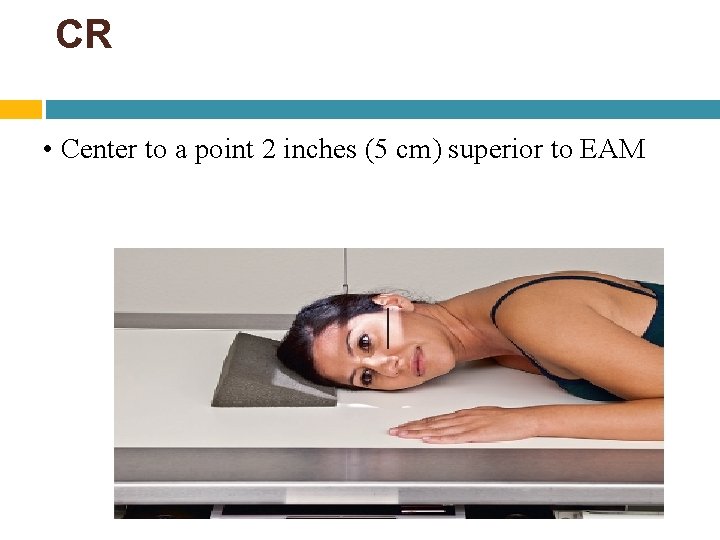 CR • Center to a point 2 inches (5 cm) superior to EAM CR • Center to a point 2 inches (5 cm) superior to EAM