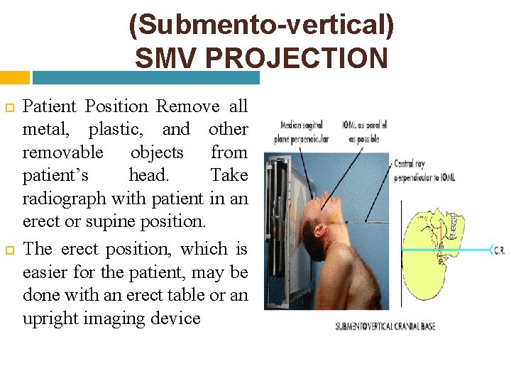 (Submento-vertical) SMV PROJECTION Patient Position Remove all metal, plastic, and other removable objects from (Submento-vertical) SMV PROJECTION Patient Position Remove all metal, plastic, and other removable objects from