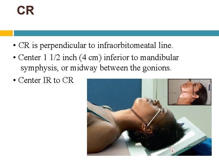 CR • CR is perpendicular to infraorbitomeatal line. • Center 1 1/2 inch (4 CR • CR is perpendicular to infraorbitomeatal line. • Center 1 1/2 inch (4