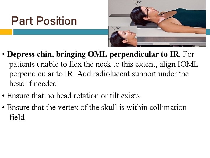Part Position • Depress chin, bringing OML perpendicular to IR. For patients unable to
