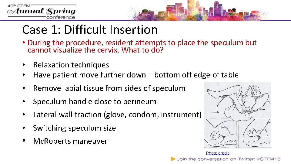 Case 1: Difficult Insertion • During the procedure, resident attempts to place the speculum Case 1: Difficult Insertion • During the procedure, resident attempts to place the speculum