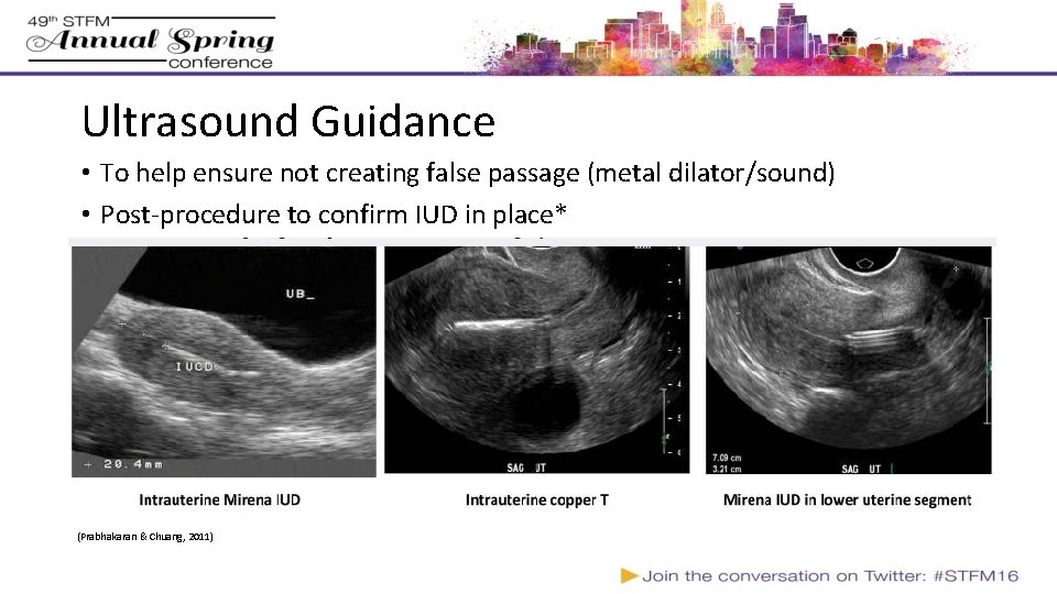Ultrasound Guidance • To help ensure not creating false passage (metal dilator/sound) • Post-procedure Ultrasound Guidance • To help ensure not creating false passage (metal dilator/sound) • Post-procedure