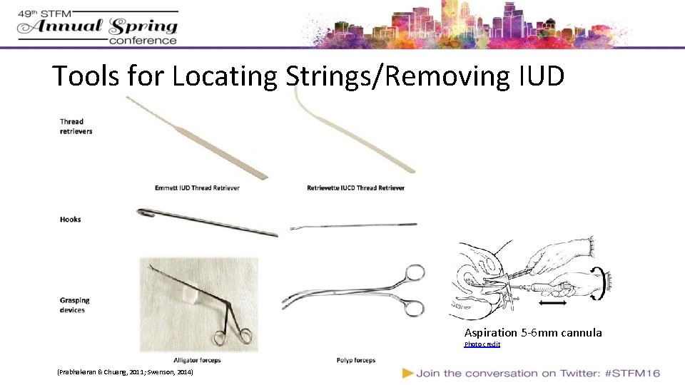 String van iud rondhangen