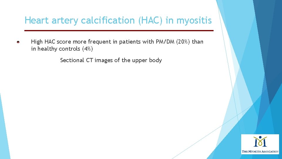 Heart artery calcification (HAC) in myositis High HAC score more frequent in patients with