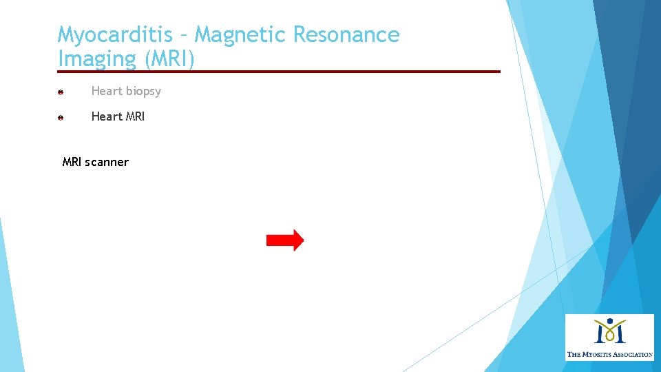 Myocarditis – Magnetic Resonance Imaging (MRI) Heart biopsy Heart MRI scanner 