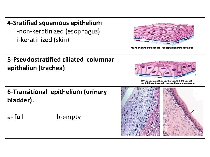 4 -Sratified squamous epithelium i-non-keratinized (esophagus) ii-keratinized (skin) 5 -Pseudostratified ciliated columnar epitheliun (trachea)