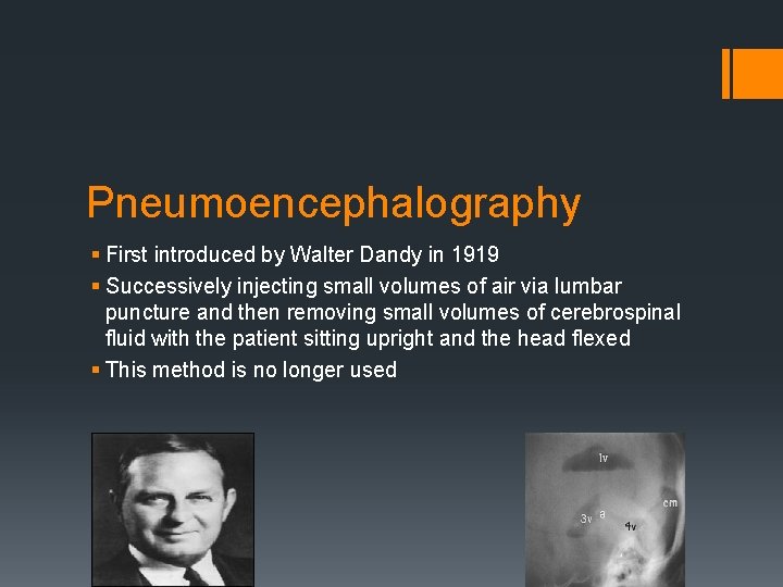 Pneumoencephalography § First introduced by Walter Dandy in 1919 § Successively injecting small volumes