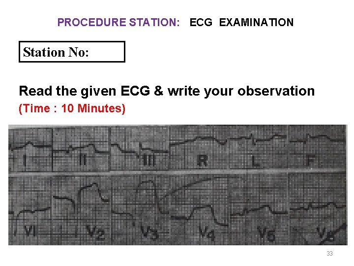 PROCEDURE STATION: ECG EXAMINATION Station No: Read the given ECG & write your observation