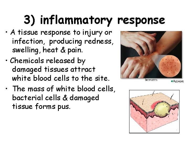 3) inflammatory response • A tissue response to injury or infection, producing redness, swelling,