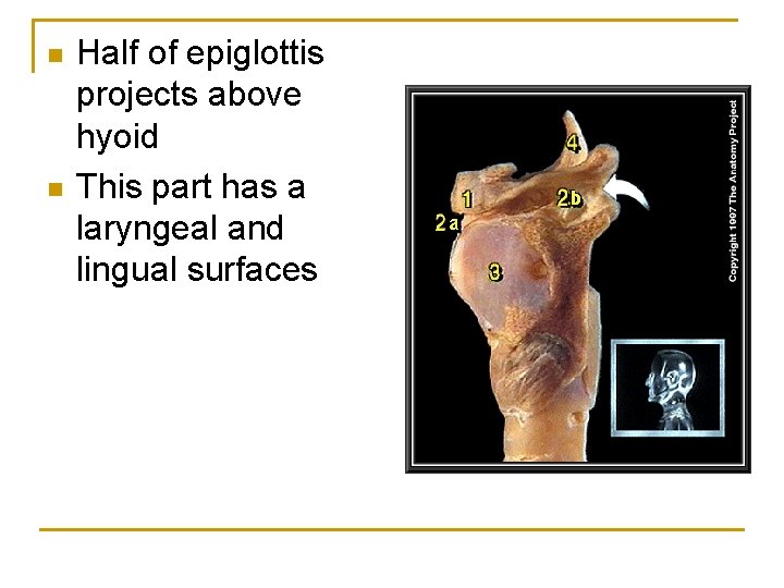 n n Half of epiglottis projects above hyoid This part has a laryngeal and