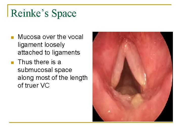 Reinke’s Space n n Mucosa over the vocal ligament loosely attached to ligaments Thus